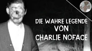 Die wahre Geschichte von Charlie no face | urban legends