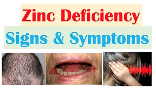 Zinc Deficiency Signs & Symptoms (ex. Hair Loss, Acne, Infections) & Why They Occur