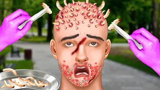 ASMR Maggots on man's head | ASMR Animation