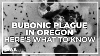 Central Oregon resident diagnosed with bubonic plague