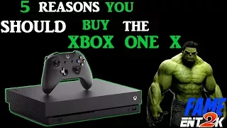 Top 5 Reasons You Should Buy The Xbox One X