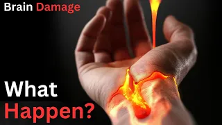 What happens If 2 Drops of Lava Fell On Your Body?