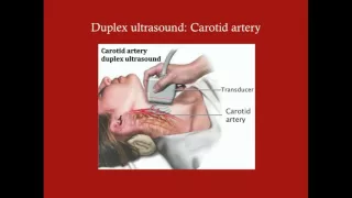 Carotid Artery Disease - CRASH! Medical Review Series