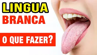 Já teve LINGUA BRANCA? Causas e O QUE FAZER!