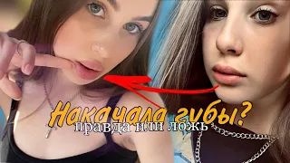 Леди Диана накачала губы / ПРАВДА ЛОЖЬ