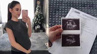 35 НЕДЕЛЬ БЕРЕМЕННОСТИ 🤰| ТРЕНИРОВОЧНЫЕ СХВАТКИ| 22.12.21