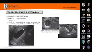 52 ROL DE LA ECOGRAFÍA EN OBSTETRICIA Y GINECOLOGÍA