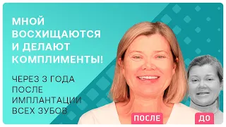 Как стать моложе и еще красивее без пластики? Рассказываю свою историю