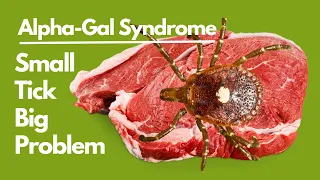 Meat Allergy: The Alpha-gal Syndrome | Alpha-gal Syndrome | Meat Allergy Tick| Red Meat Allergy Tick