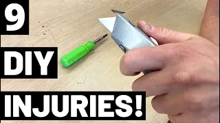 9 MOST OVERLOOKED DIY INJURIES! (Avoid These 9 Worst DIY Injuries/Accidents From Common Tools!)