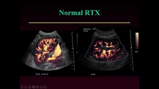 Imaging of Kidney and Liver Transplantation by Edward G. Grant, M.D., FACR