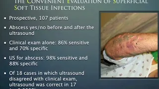 Soft Tissue Ultrasound