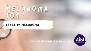 What is Stage IV Melanoma?