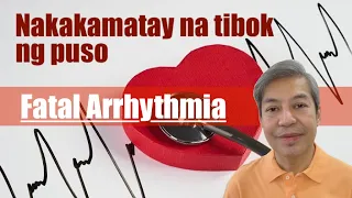 Nakakamatay na tibok ng puso: Fatal arrhythmia