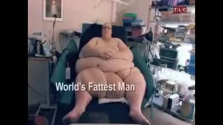 World's Fattest Man   50% Chance of Surviving