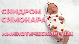 НАША ИСТОРИЯ! Я СМОГЛА И ТЫ СМОЖЕШЬ! Амниотический тяж или синдром Симонара