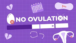 Ovulation Problems: Understanding Anovulation