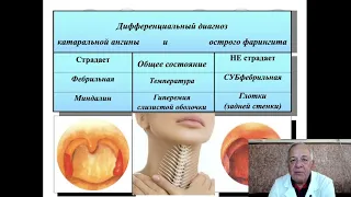 Лекция:Заболевания глотки, гортани.ОНМедУ.Кафедра Оториноларингологии.Проф.Пухлик Сергей Михайлович.