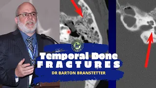 TMT: Temporal Bone Fractures by Dr Barton Branstetter