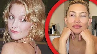 Unrecognizable Celebrities Who Had TOO Much Plastic Surgery | Marathon