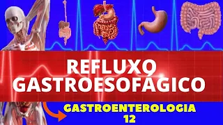 REFLUXO GASTROESOFAGICO  ( CAUSAS, SINTOMAS, DIAGNÓSTICO E TRATAMENTO) - GASTROENTEROLOGIA