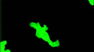 Aneously firing neurons observed using FluoVolt™ Membrane Potential Dye