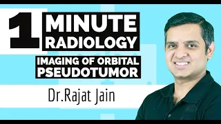 One Minute Radiology #imagingoforbitalpseudotumor || Dr.RajatJain