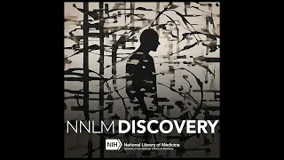 NNLM Discovery | Towards a Smart Bionic Eye