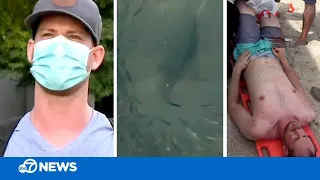 Man describes bizarre shark attack where he was bitten 6 times while swimming in Florida