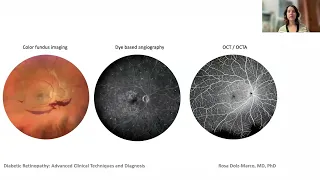 Lecture: Diabetic Retinopathy: Clinical Techniques and Diagnosis for Patient Monitoring & Management