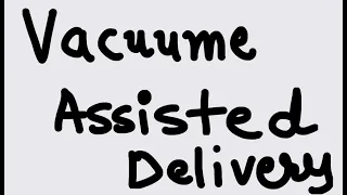 Vacuum Assisted Delivery -