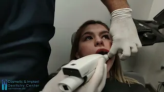 All on 4 Dental Implant Center Los Algodones Mexico