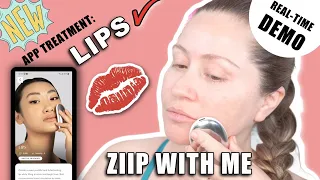ZIIP HALO💋 LIP PLUMPING TREATMENT | w/ before & After