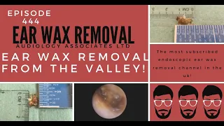 EAR WAX REMOVAL FROM THE VALLEY - EP444