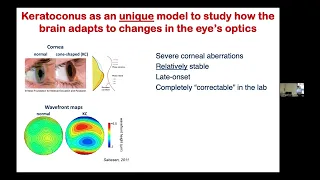 Flaum Eye Institute April 2024 Grand Rounds