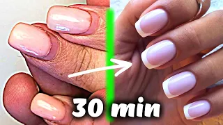 EXTREME GROWN NAILS TRANSFORMATION IN 30 MIN WITH THE MOST EFFECTIVE TECHNIQUE STEP BY STEP TUTORIAL