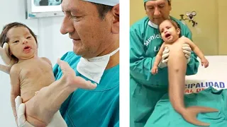 עשר אנשים שנולדו עם איברים משונים | טופטן