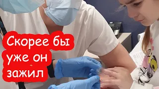 VLOG Снимаем швы на пальчике. Всё сложно