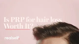 Is PRP for Hair Loss Worth It? Everything You Need to Know About This Hair Restoration Procedure