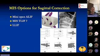 Evolution of MIS Capacity: Robert K. Eastlack, MD