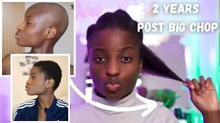 2 YEARS POST BIG CHOP | FROM BALD TO LENGTH | DAMMY DAYS