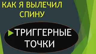 ЛЕЧЕНИЕ НАЙДЕНО! ГРЫЖИ ПОЗВОНОЧНИКА, ТРИГГЕРНЫЕ ТОЧКИ(МФС)