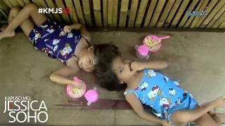 Kapuso Mo, Jessica Soho: Ang conjoined twins ng Palawan