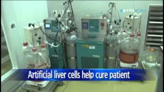 Medical team cures acute liver failure using artificial cells / YTN
