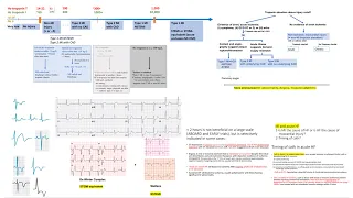 NSTEMI