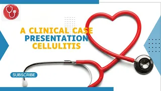A Clinical Case Presentation Cellulitis