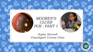 MOOREN ULCER - PUK PART 1 : ULCER STORIES #6