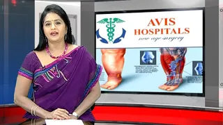 Varicose Veins and Advance Treatments Explained by Dr Rajah V Koppala  | Avis Hospitals