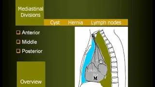 Radiology of Mediastinal lesions (in Arabic)