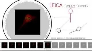 High Speed Scanning - Leica TCS SP8 with Tandem Scanner